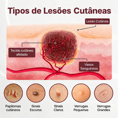 👩‍⚕️🌿𝑫𝑨𝑨𝑴𝒀® KeraErase Creme Renovador de Dupla Ação