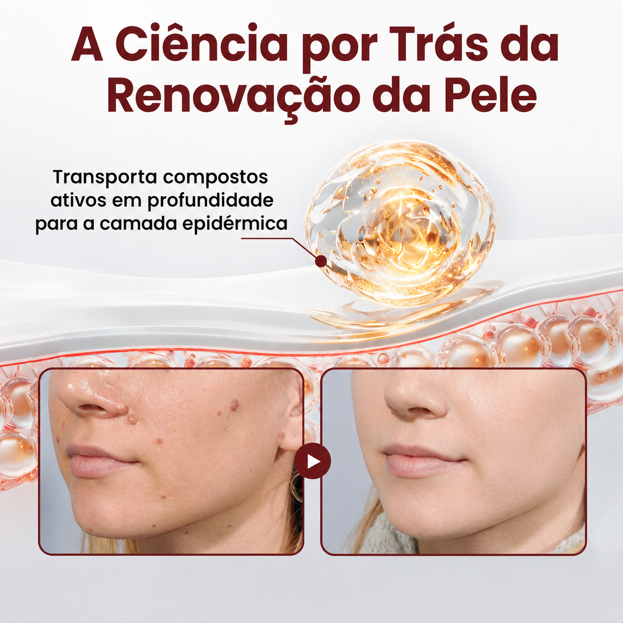 👩‍⚕️🌿𝑫𝑨𝑨𝑴𝒀® KeraErase Creme Renovador de Dupla Ação